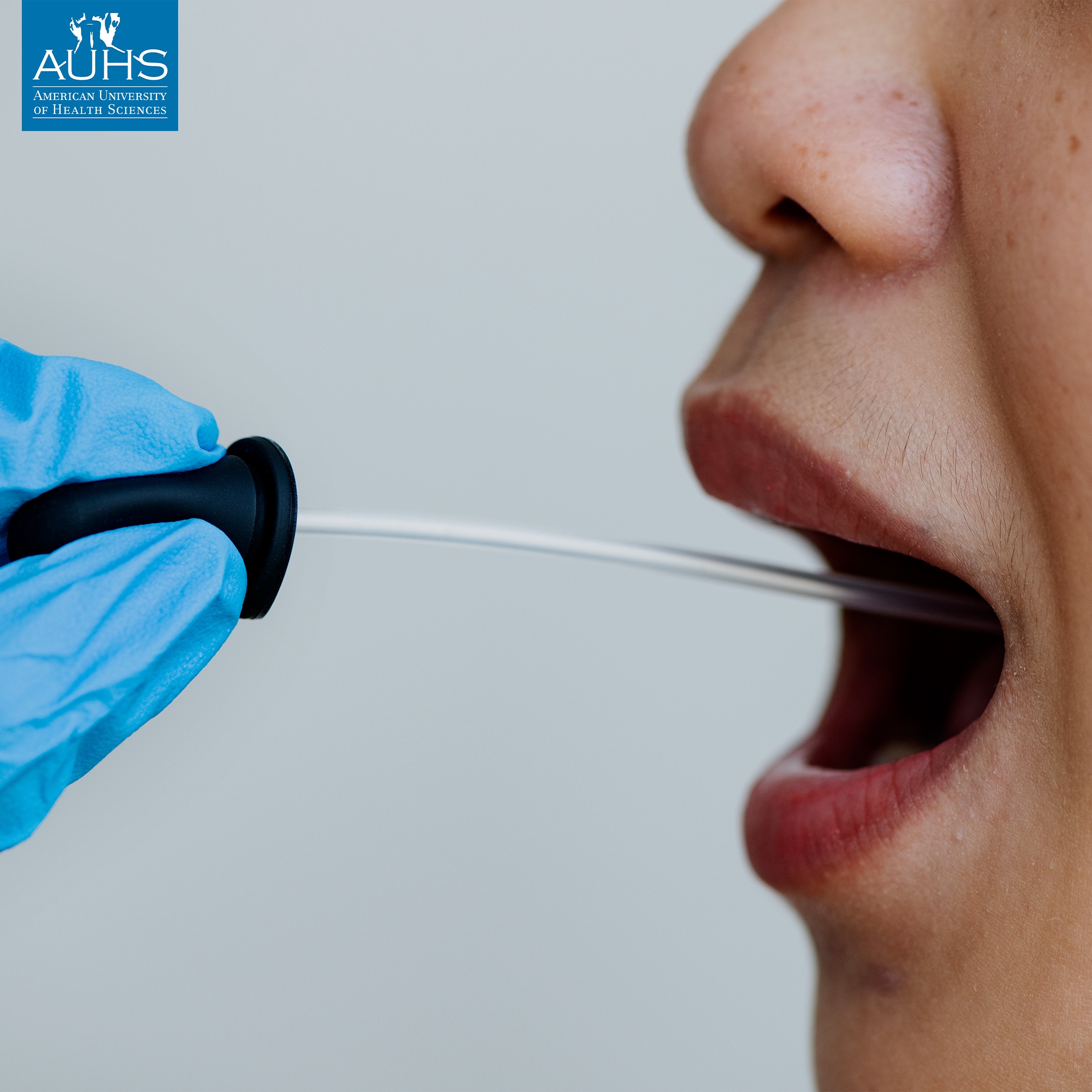 Saliva could help detecting health-related physiologic changes